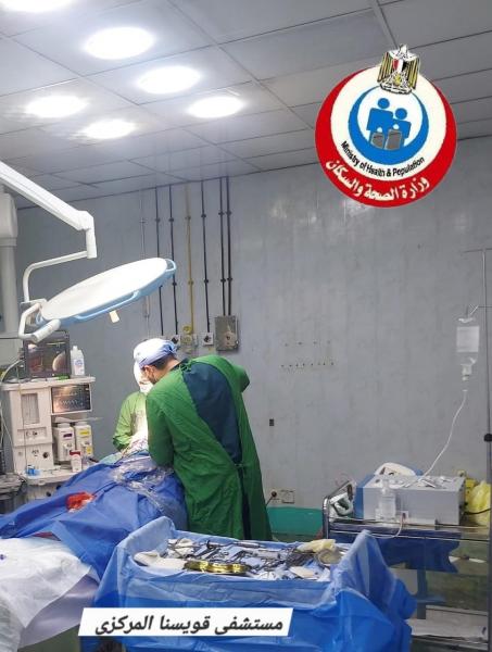 إنقاذ حياة طفلة بعد نزيف بالمخ في مستشفى قويسنا المركزي